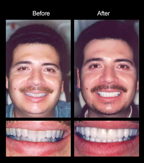 smile gallery